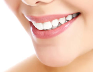 White teeth after cosmetic dentistry