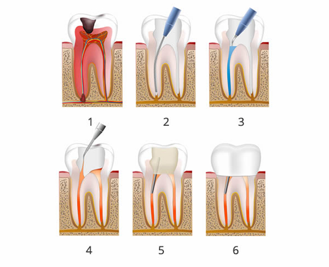 Periodontal disease and treatment