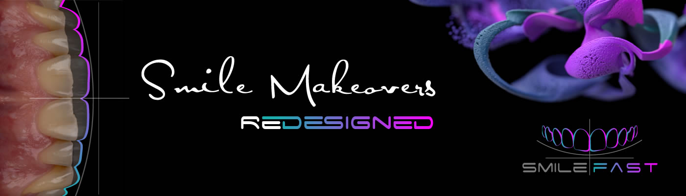 SmileFast